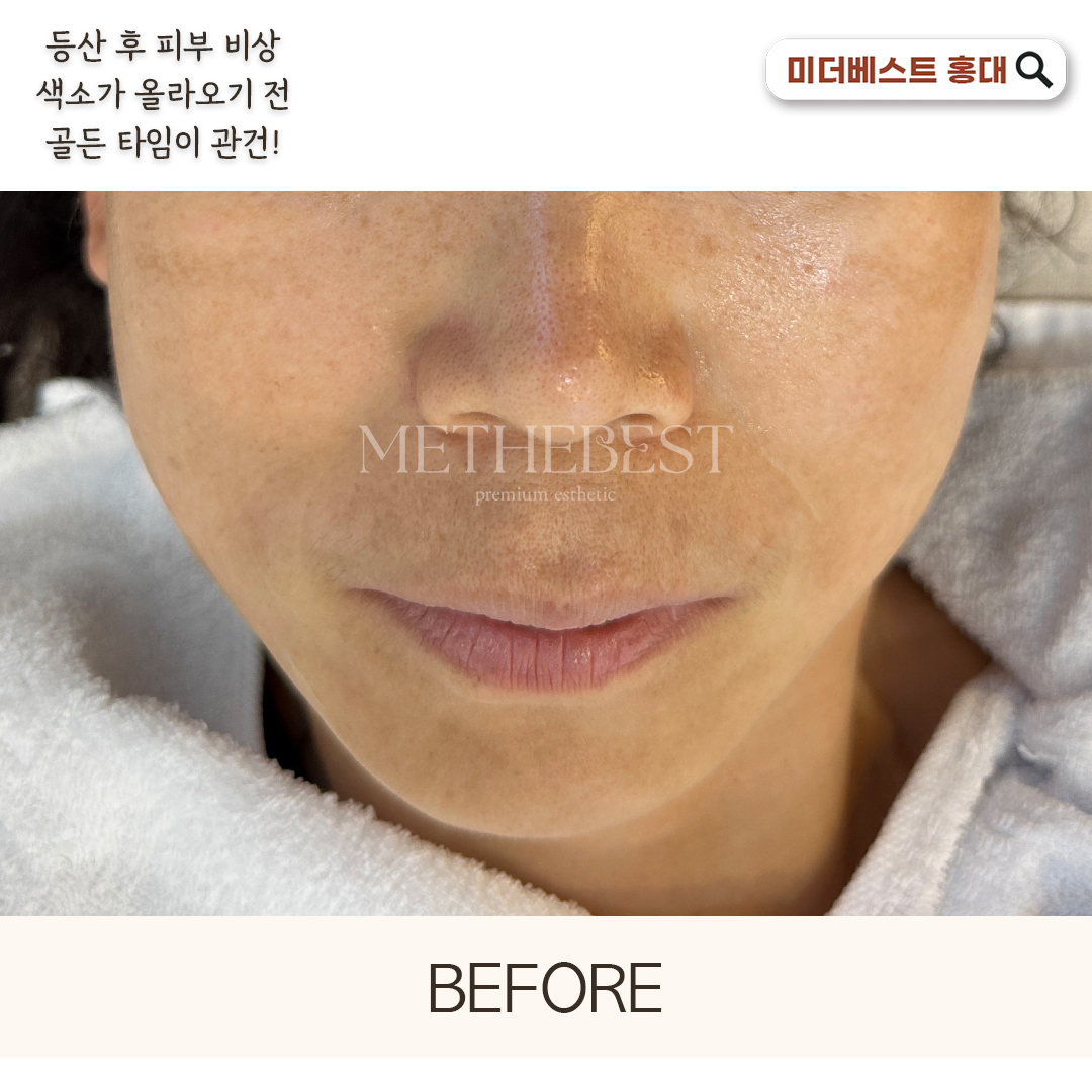 미더베스트 홍대점 대표 이미지