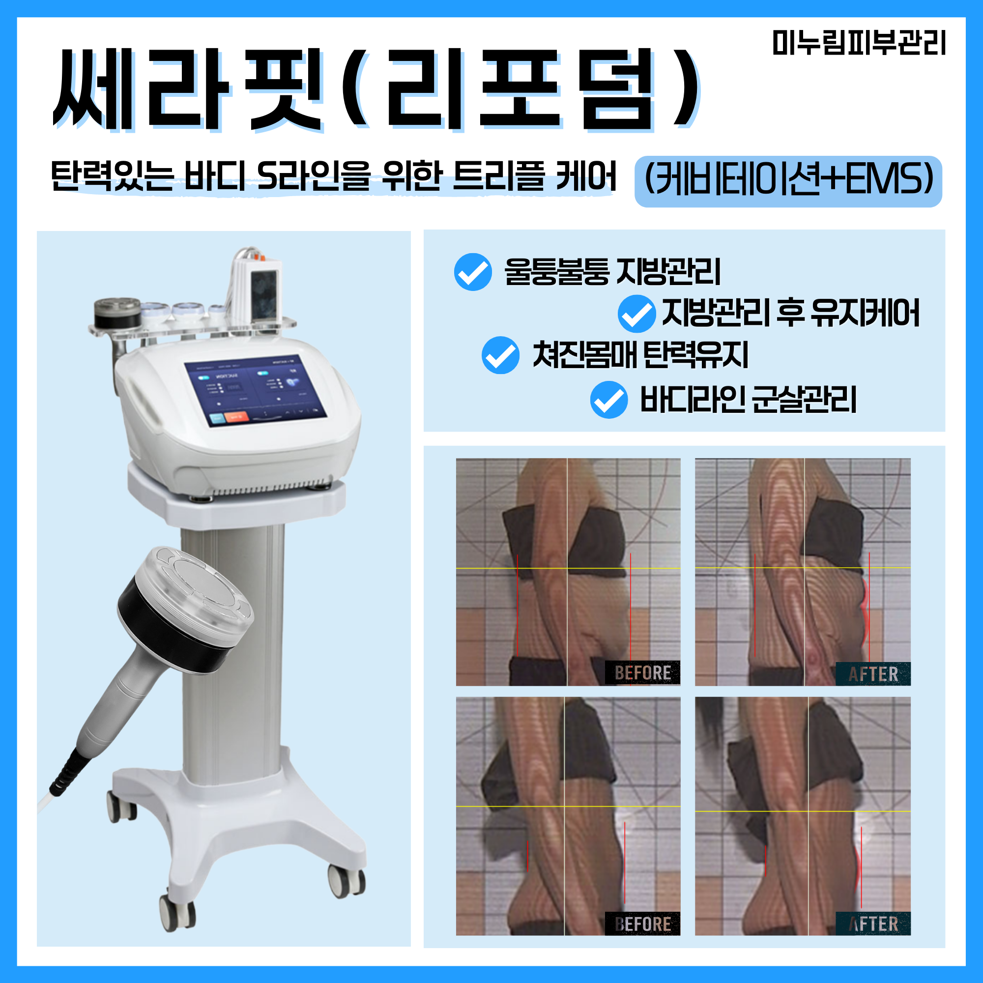 미누림 피부체형관리실