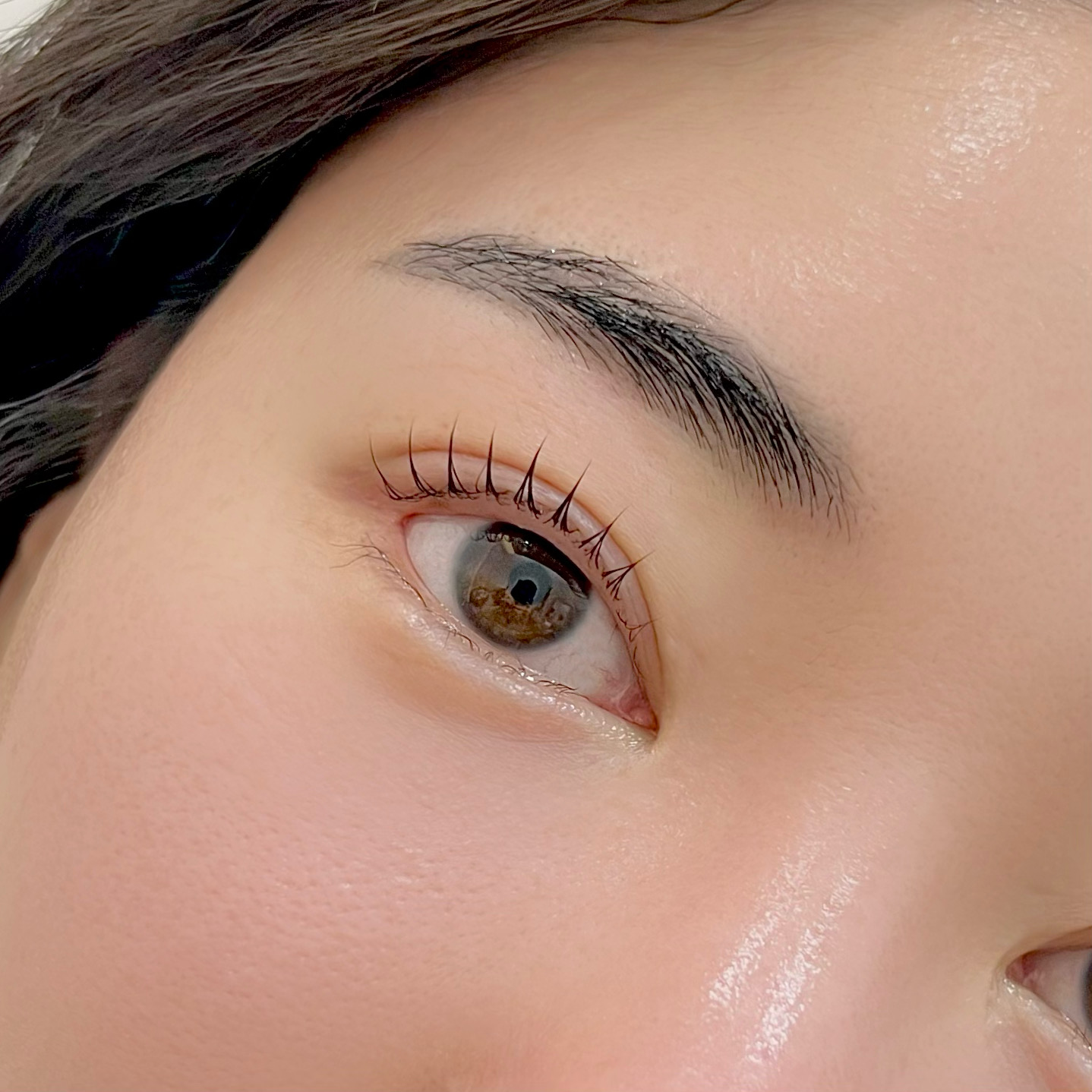 눈집 대표 이미지