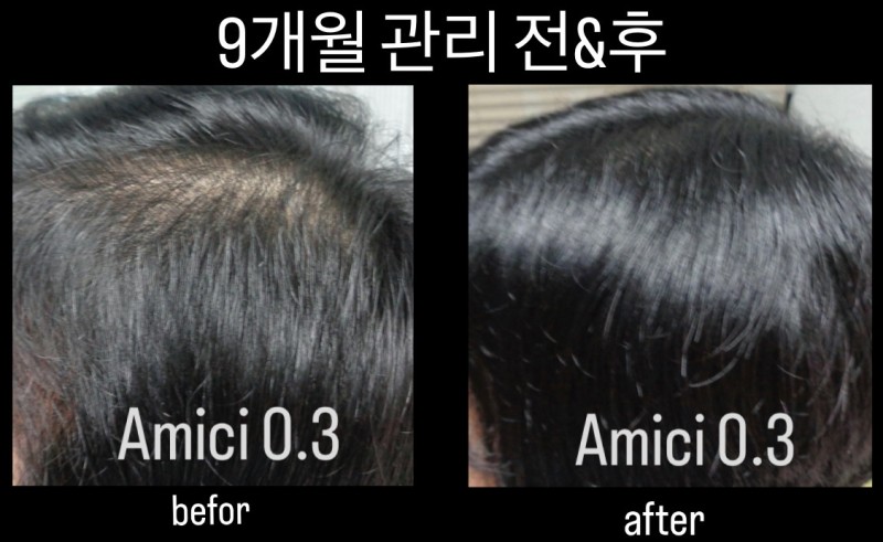 아미치0.3 이천점 대표 이미지