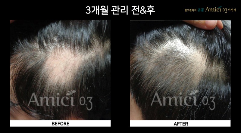 아미치0.3 이천점 대표 이미지