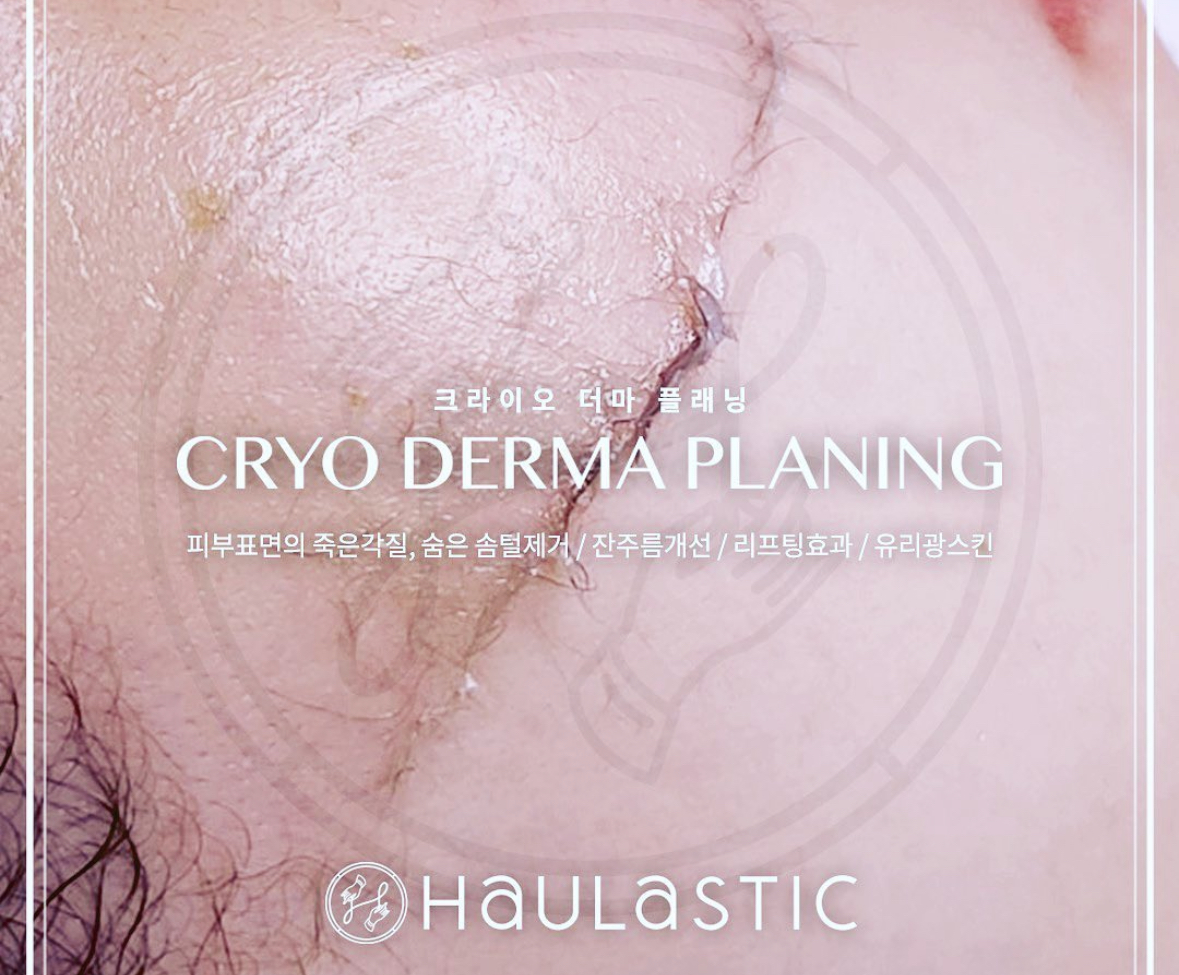 골드래쉬 대표 이미지