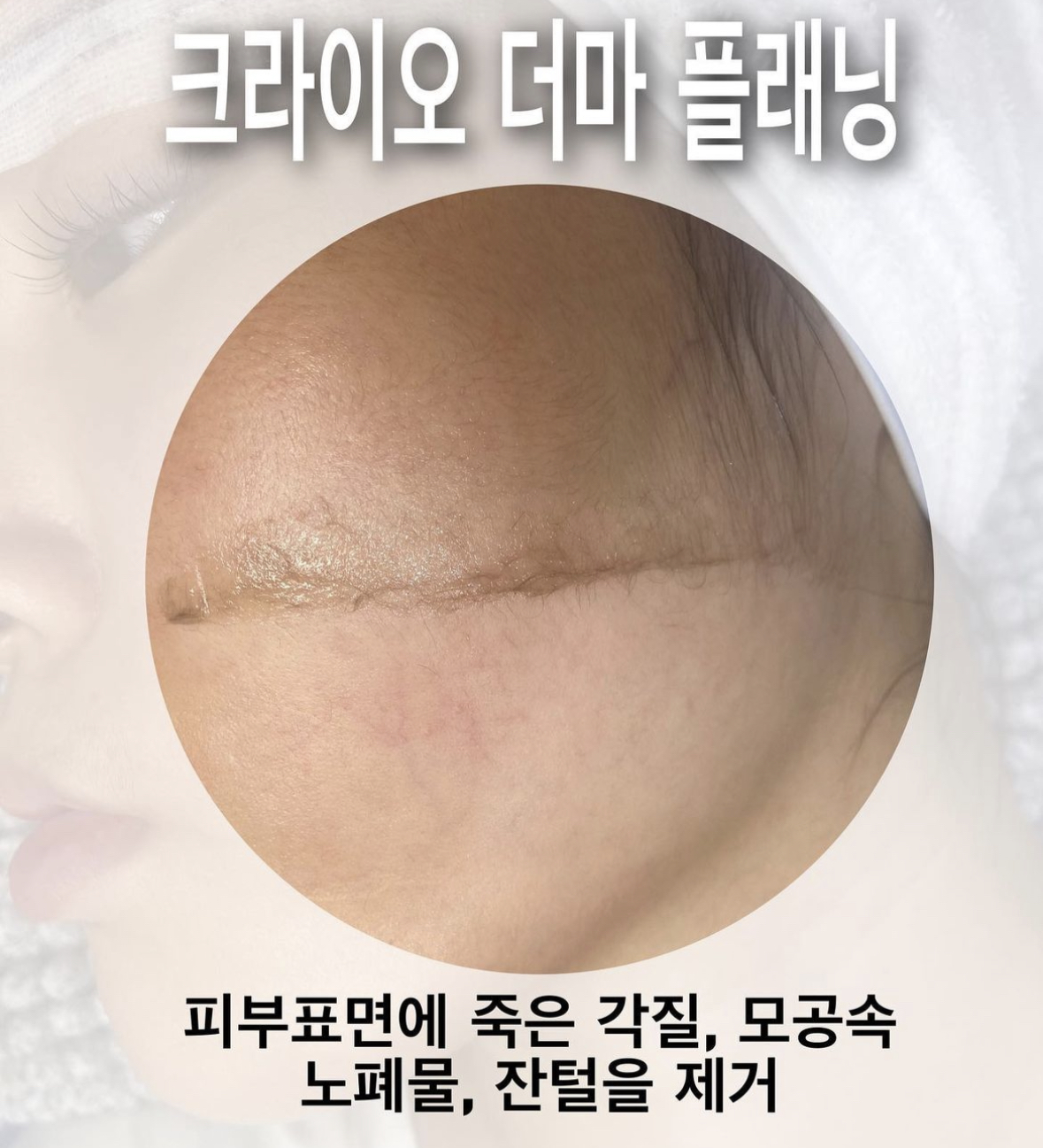 골드래쉬 대표 이미지
