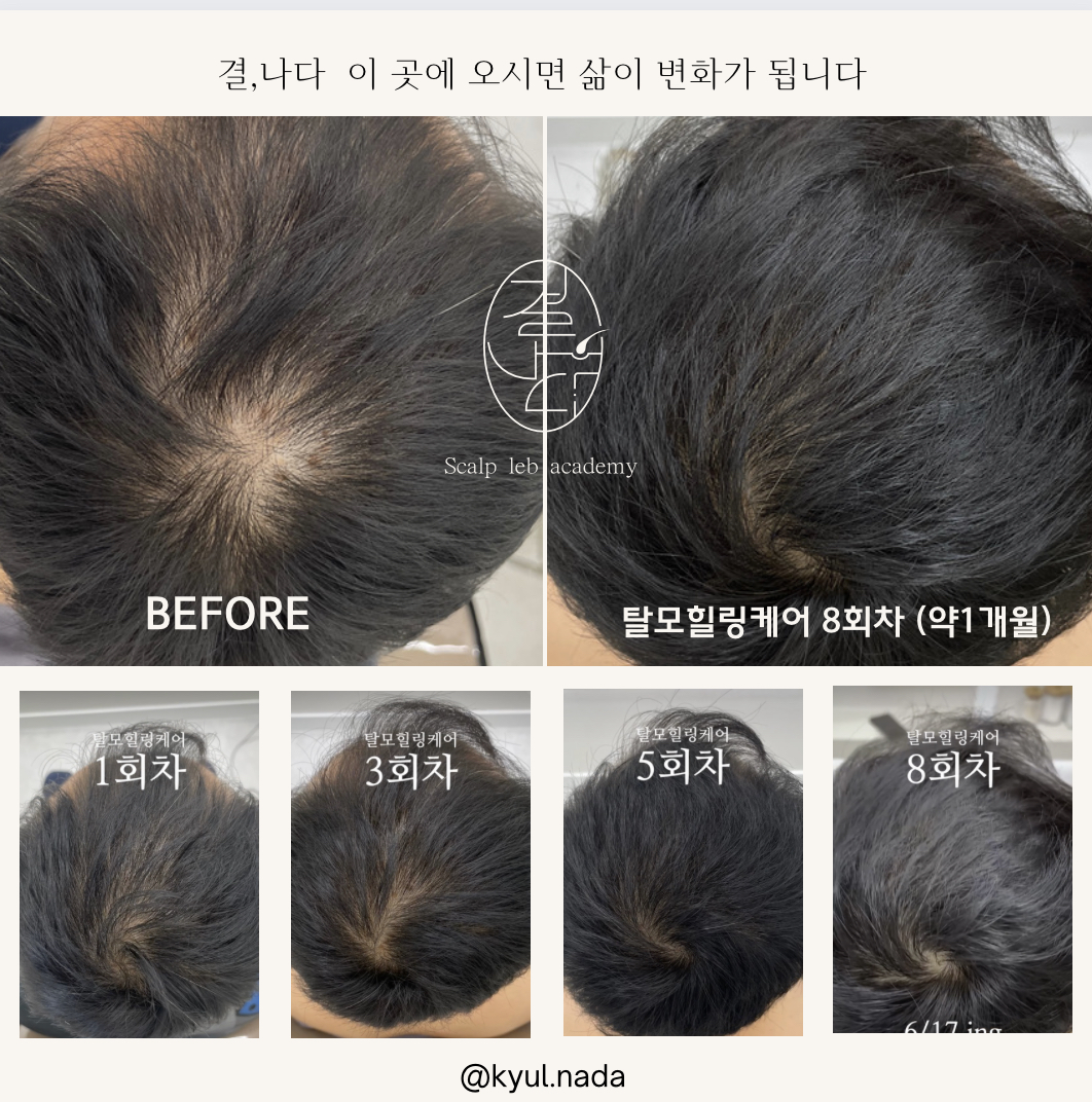 결나다
