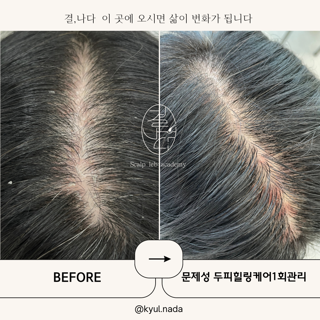결나다