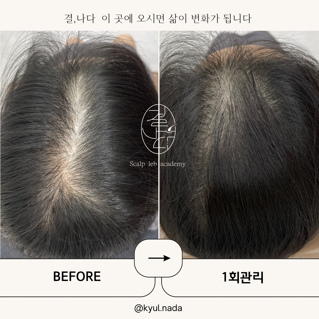 결나다