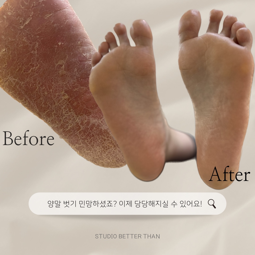 베러댄
