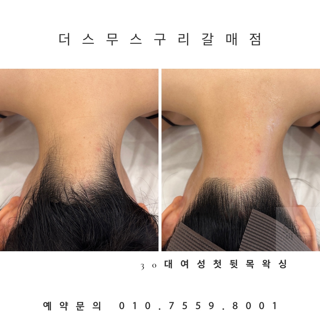 더스무스 왁싱피부 구리갈매점