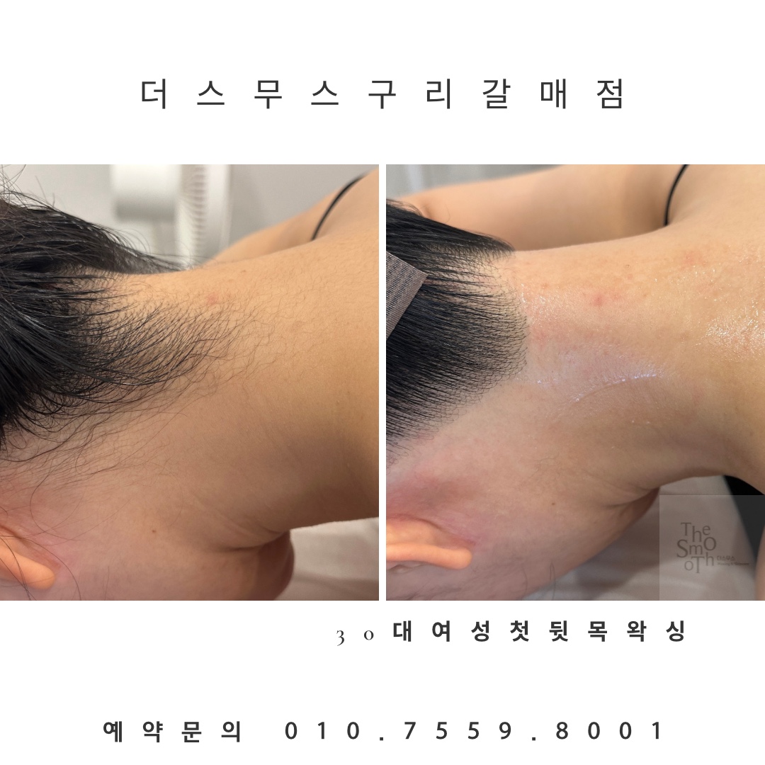 더스무스 왁싱피부 구리갈매점