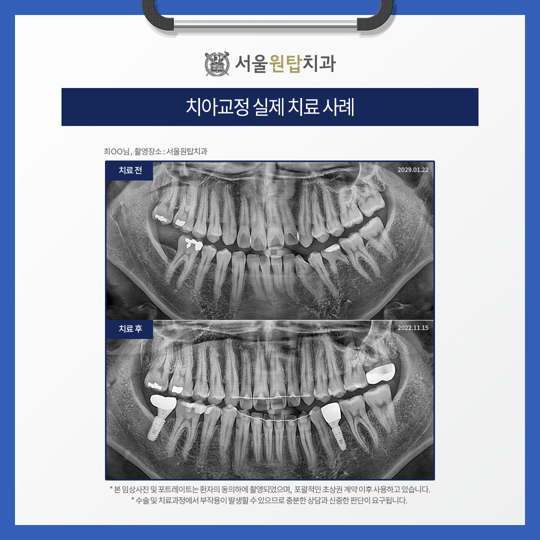 365서울원탑치과의원 대표 이미지
