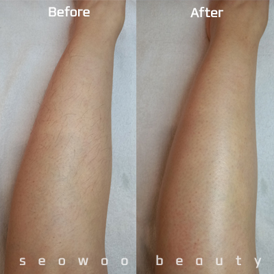 서우뷰티 대표 이미지