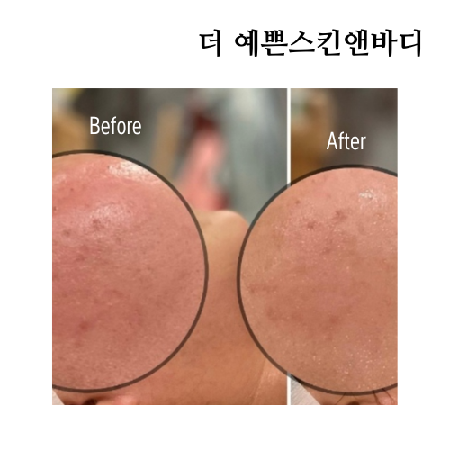 더예쁜스킨앤바디