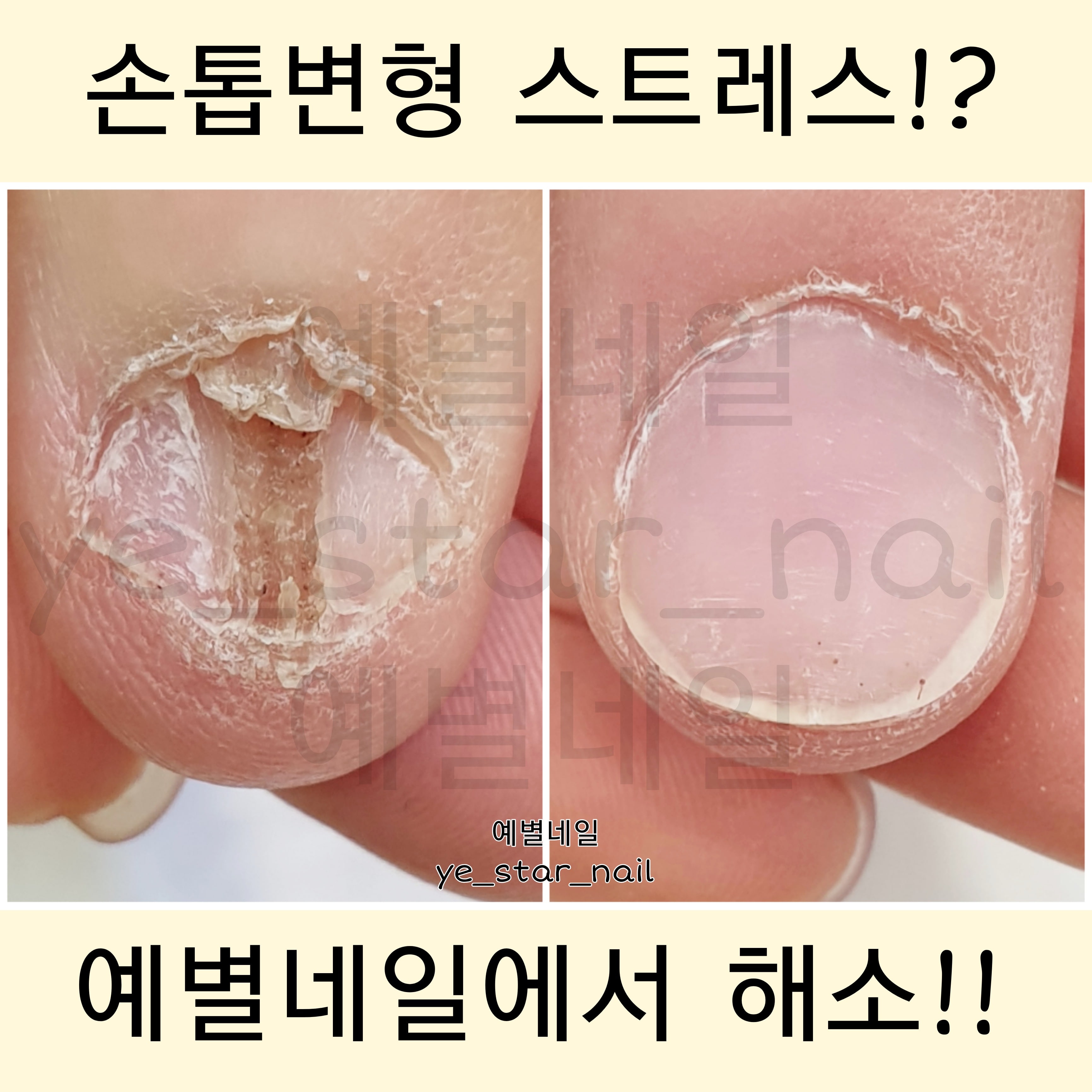 예별네일 대표 이미지