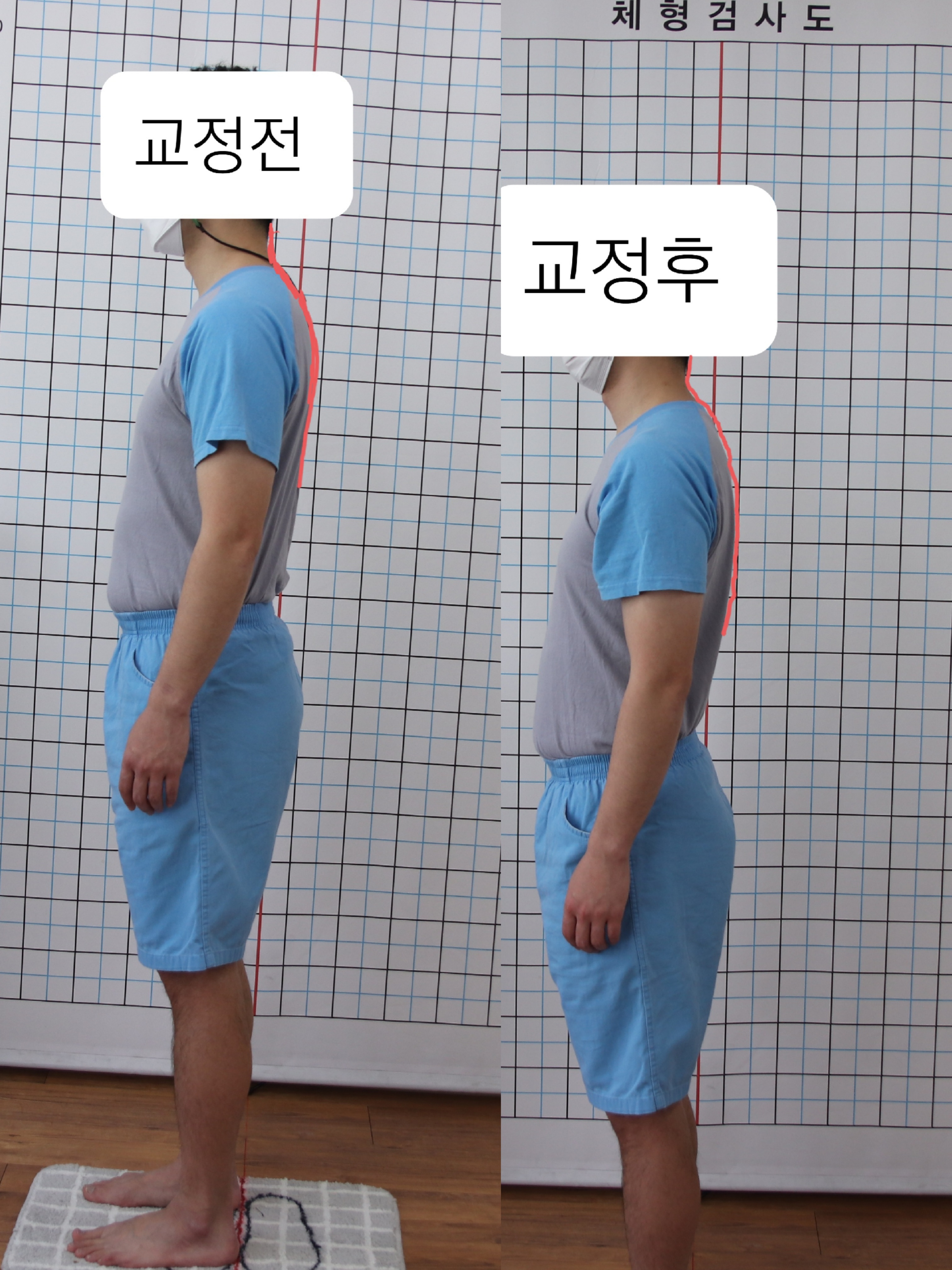 주약손체형교정명가