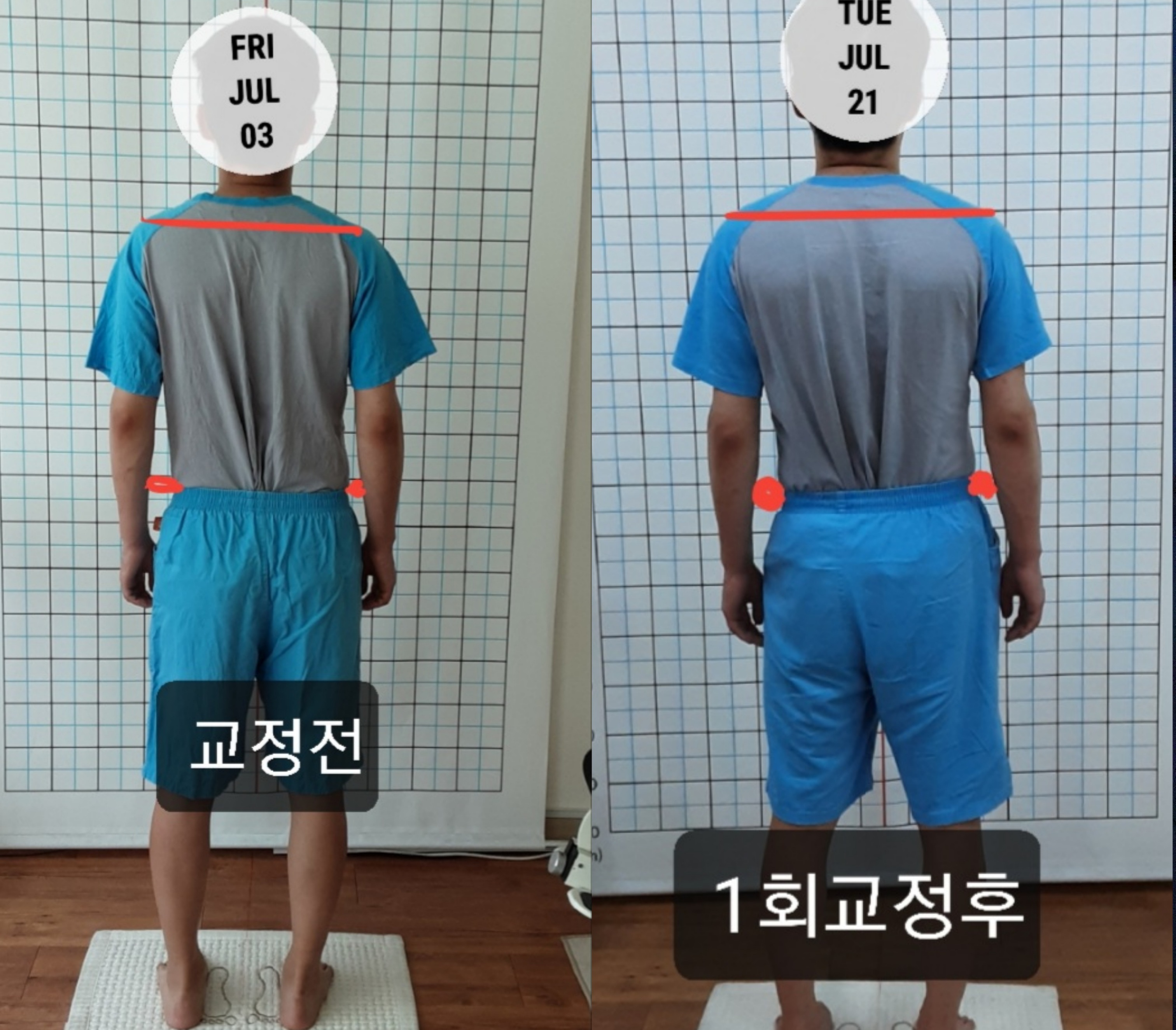 주약손체형교정명가