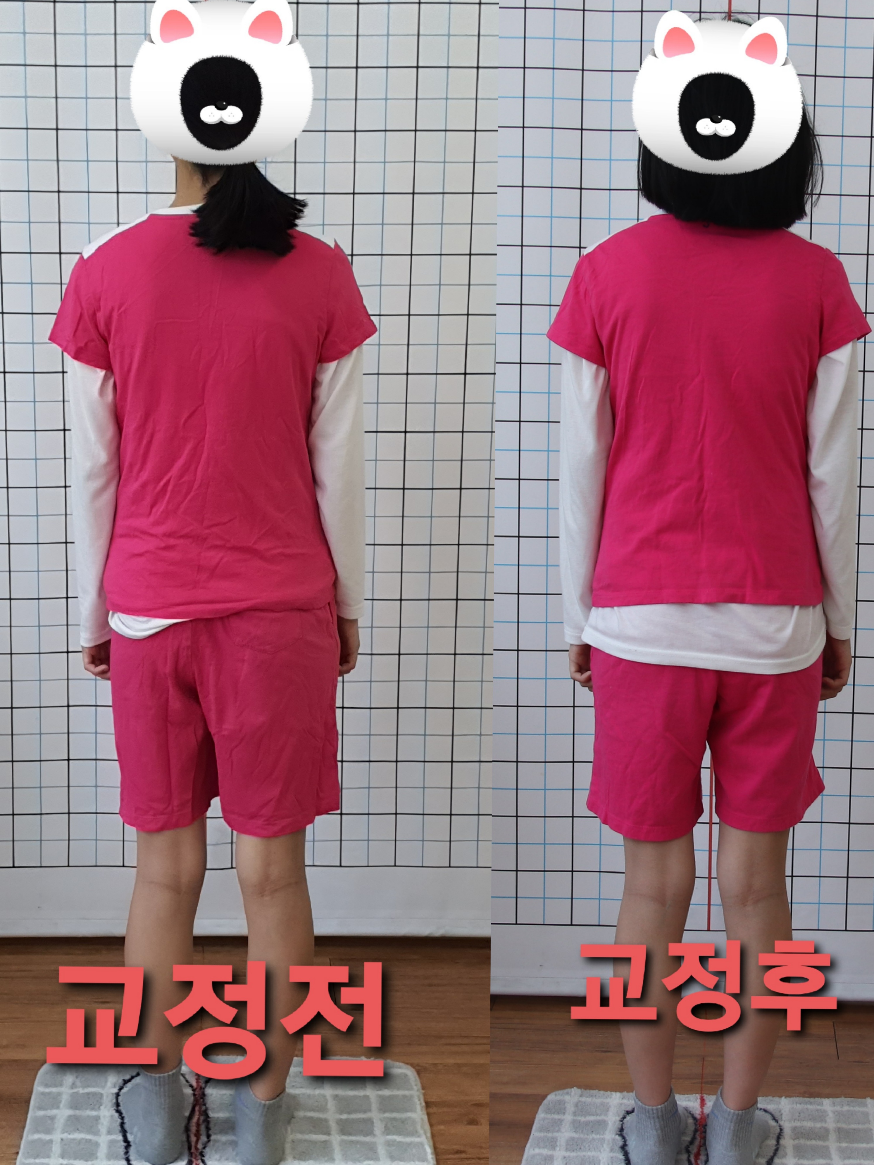 주약손체형교정명가