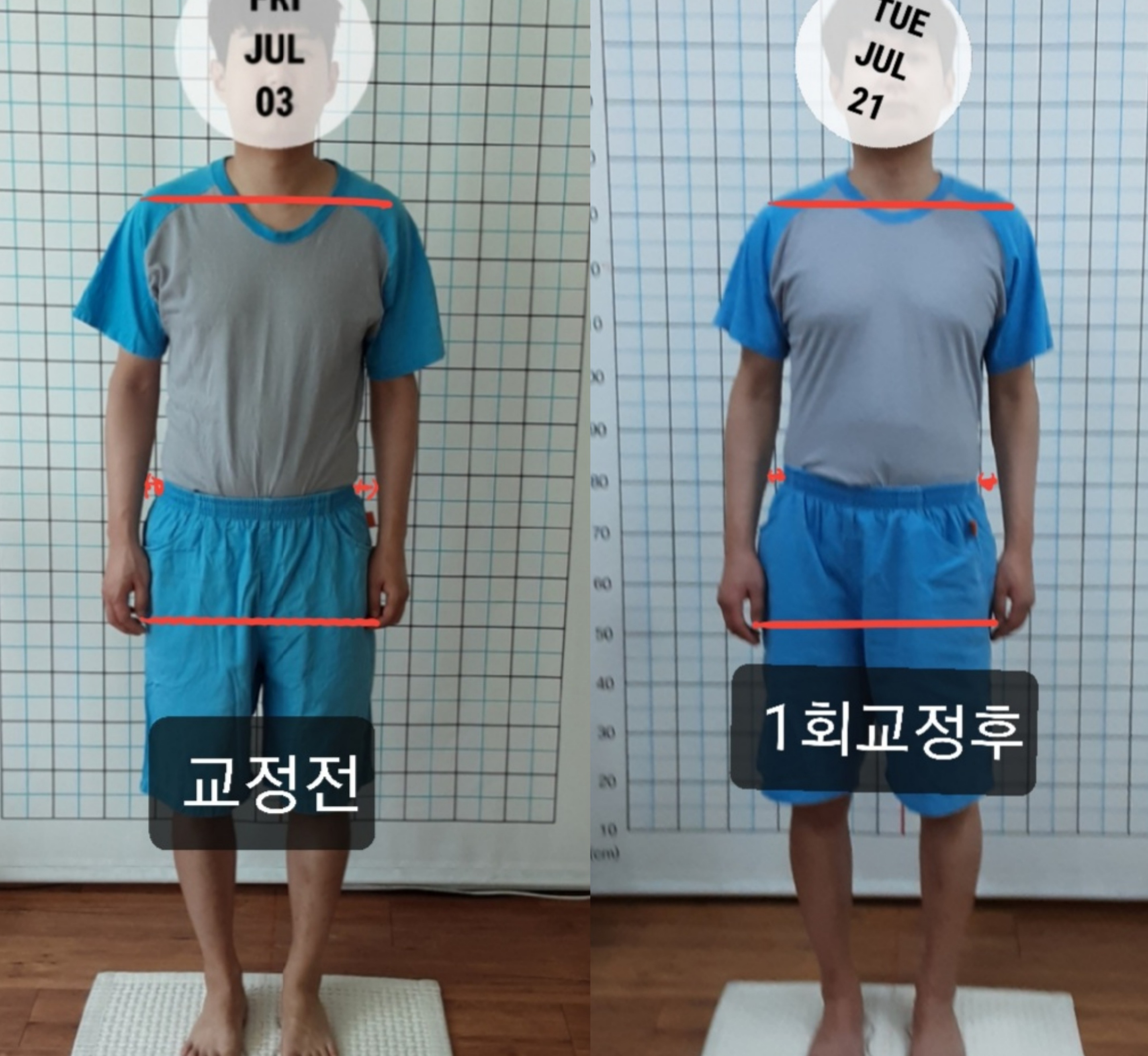 주약손체형교정명가
