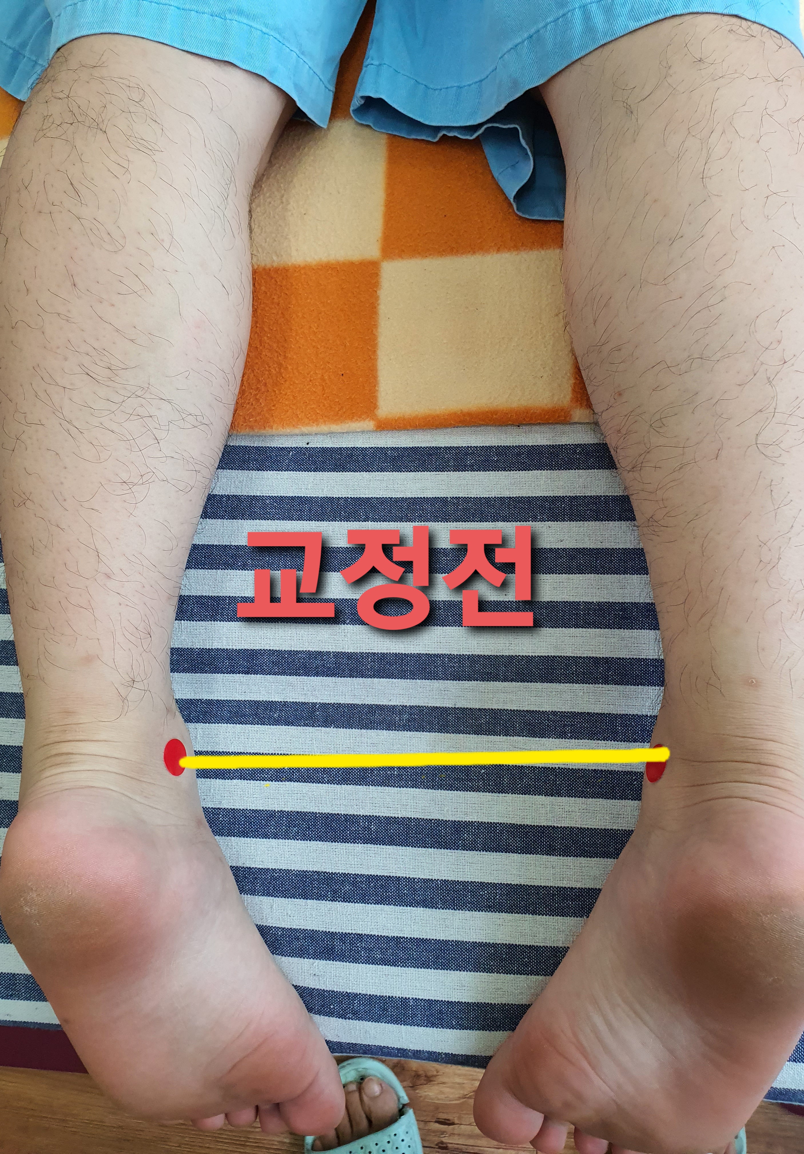 주약손체형교정명가