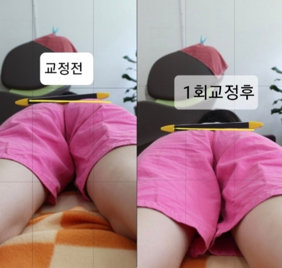 주약손체형교정명가