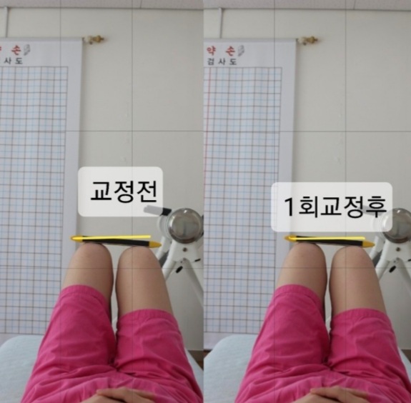 주약손체형교정명가