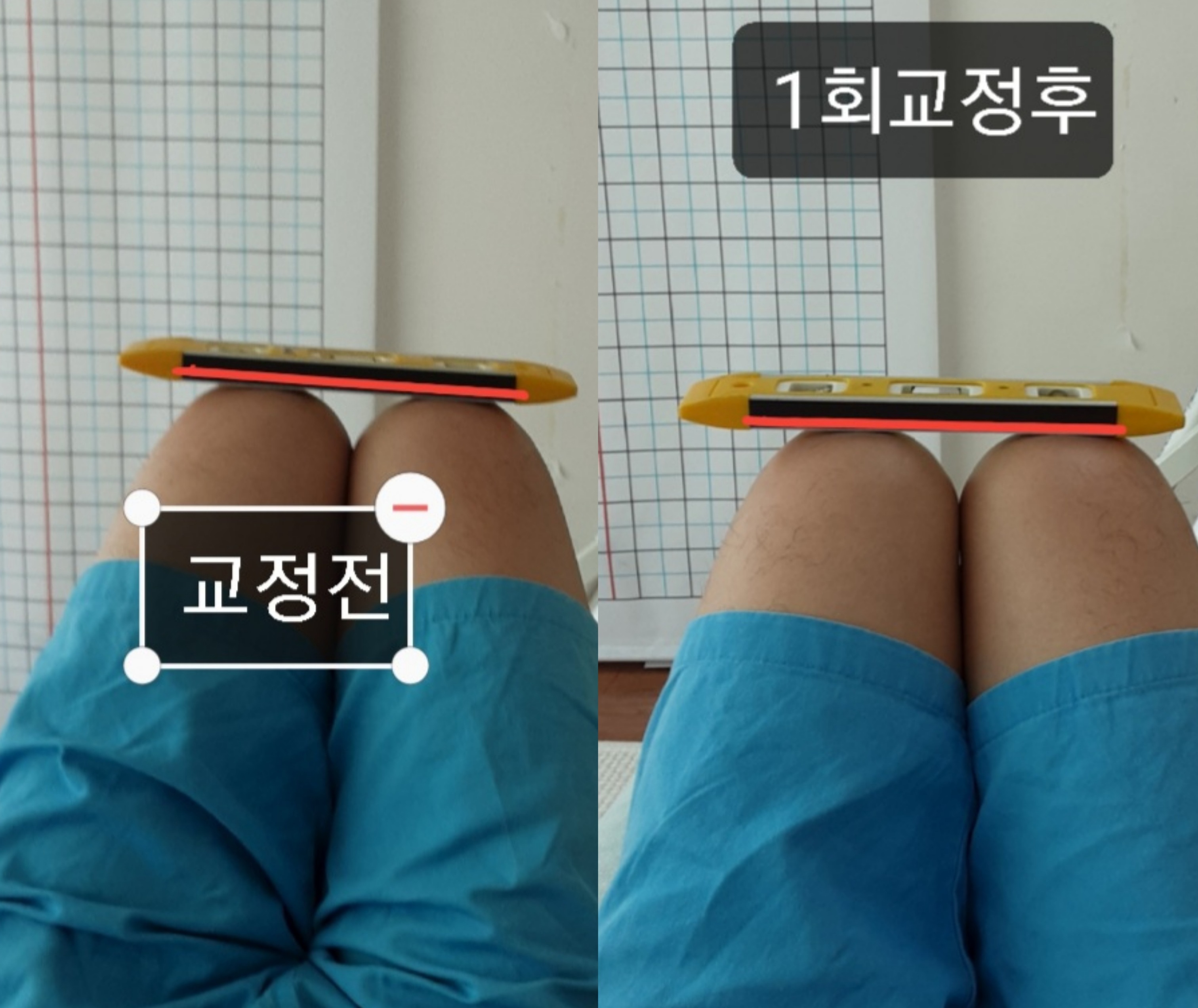 주약손체형교정명가