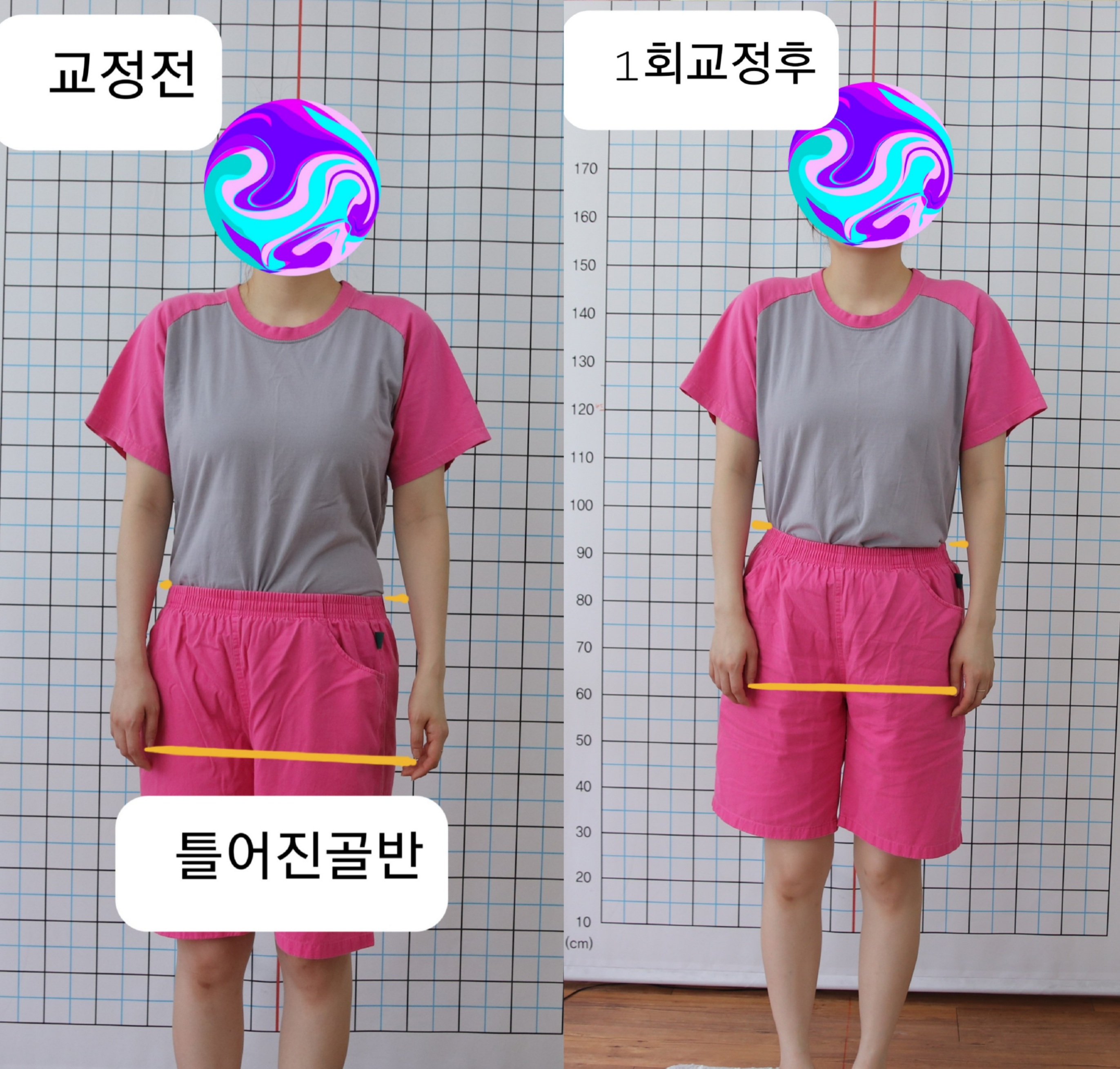 주약손체형교정명가