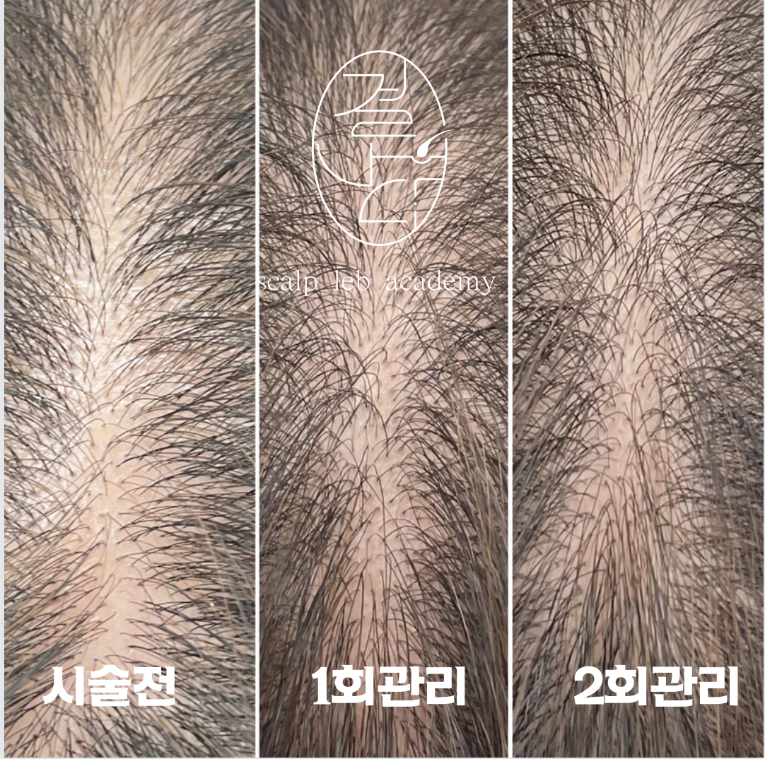 결나다