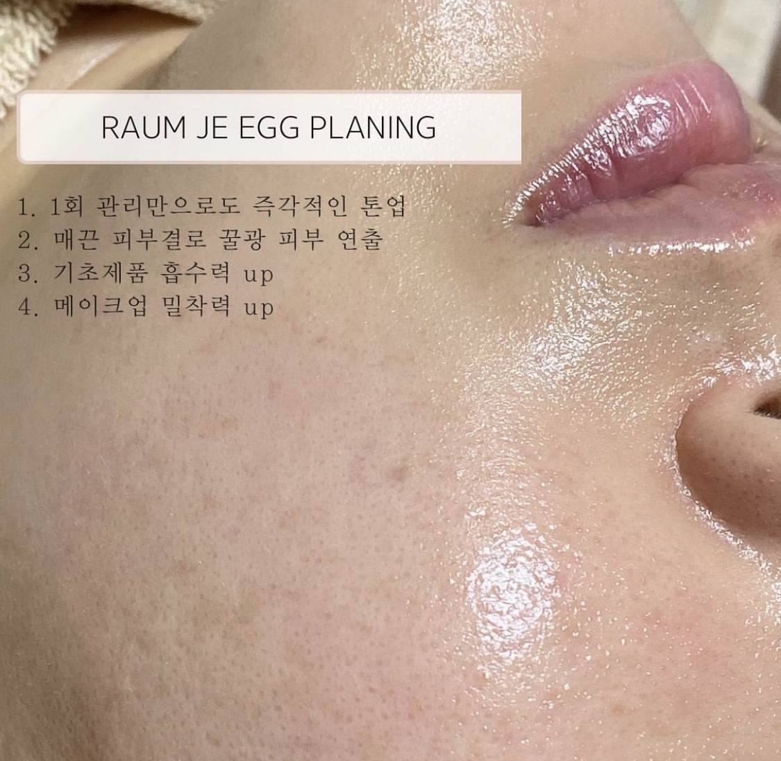 라움제이