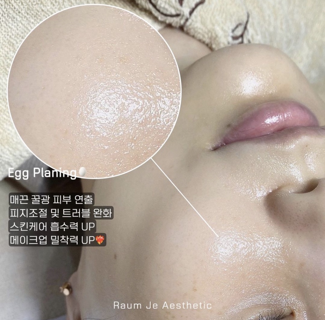 라움제이