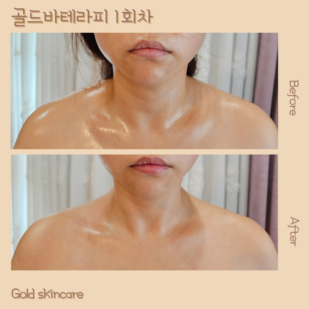 골드스킨앤바디