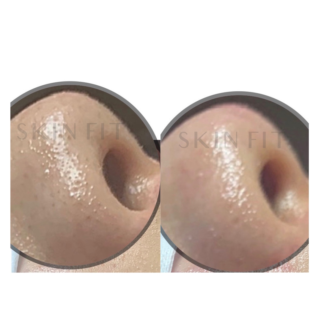 스킨핏에스테틱