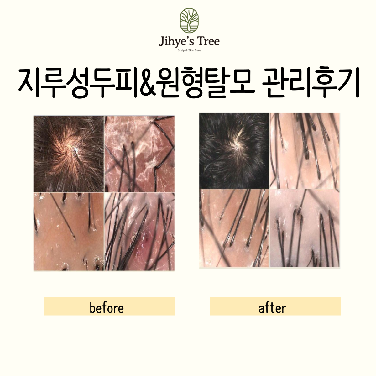 지혜스트리 대구상인점