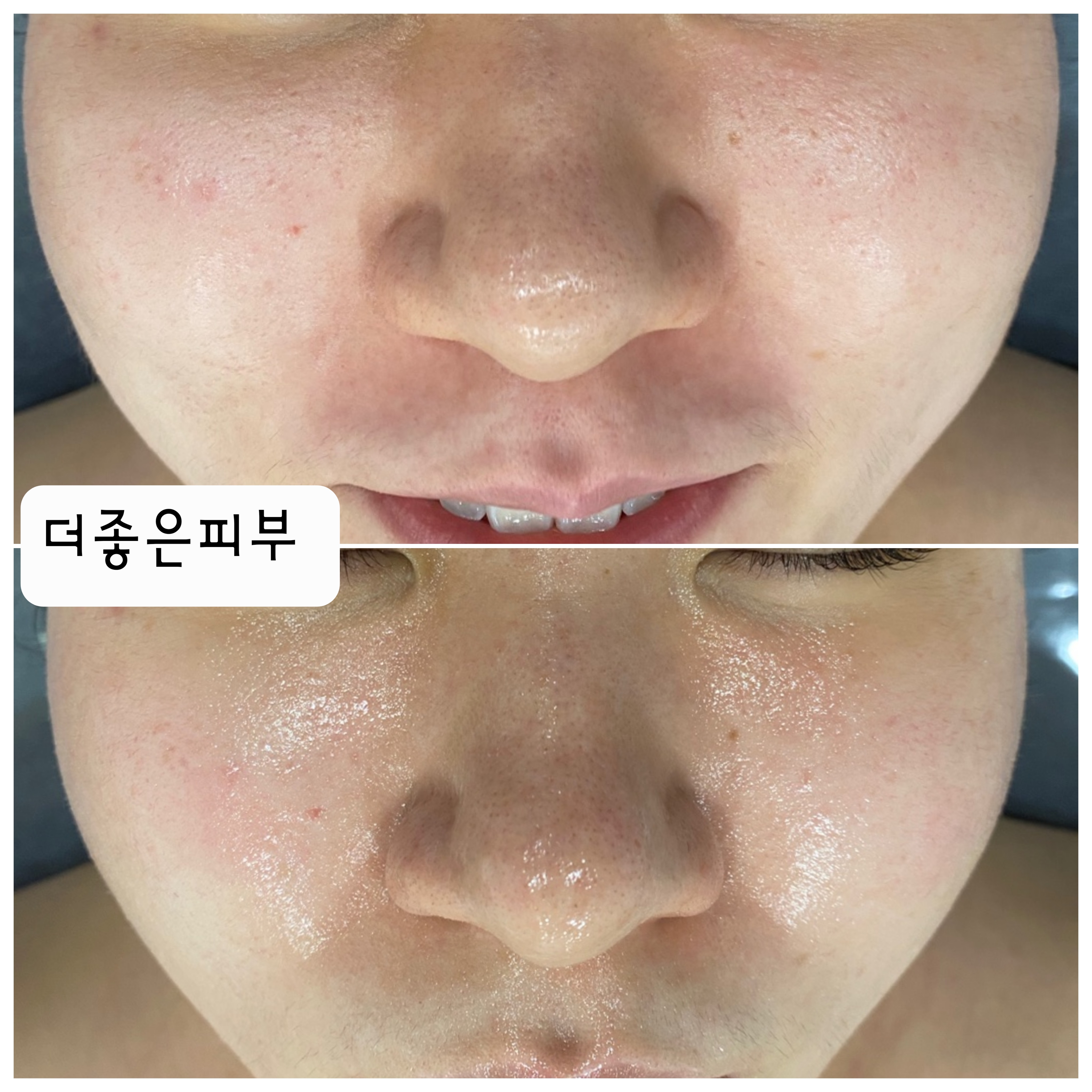 더좋은피부