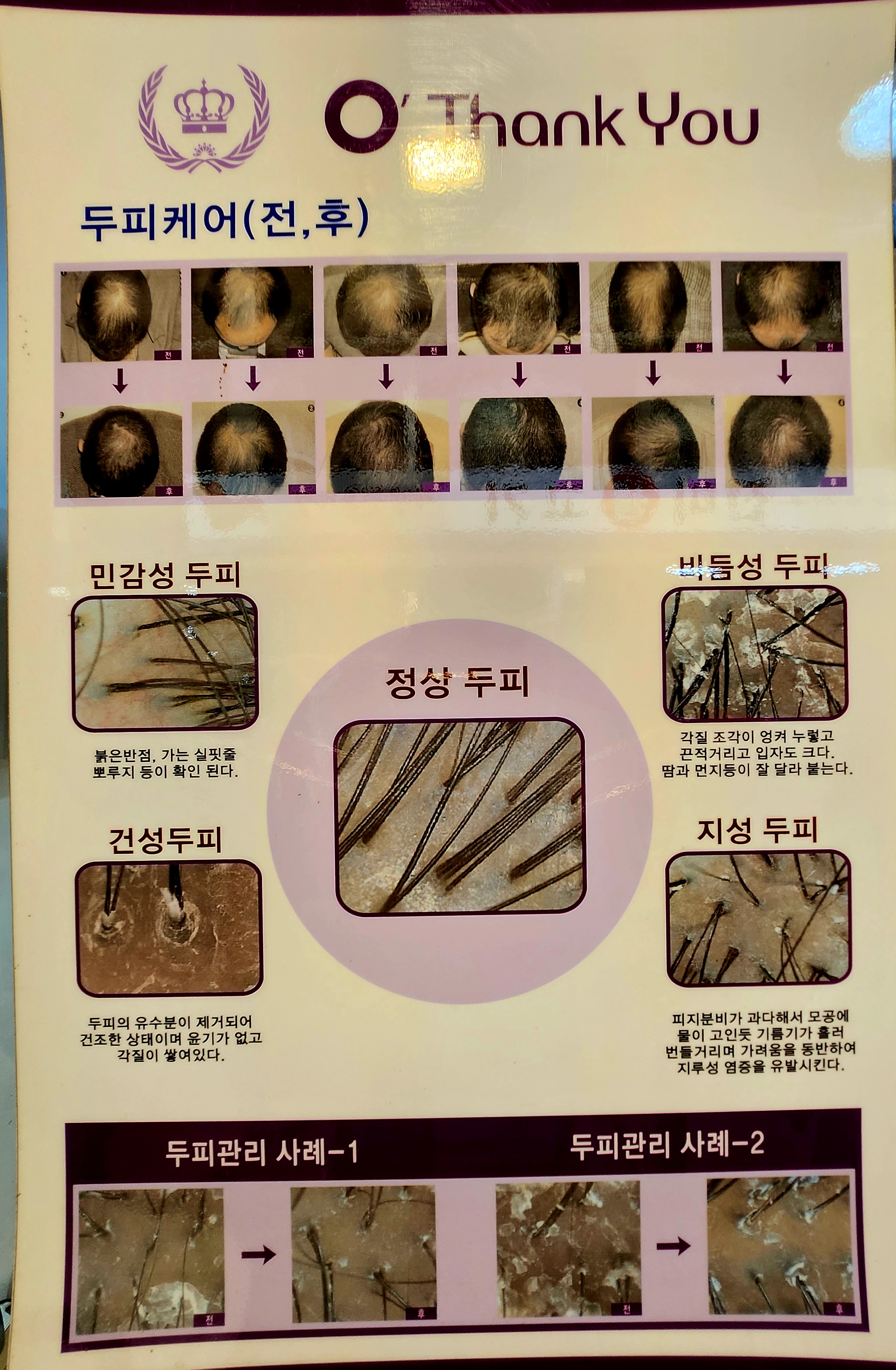 퀸스헤나