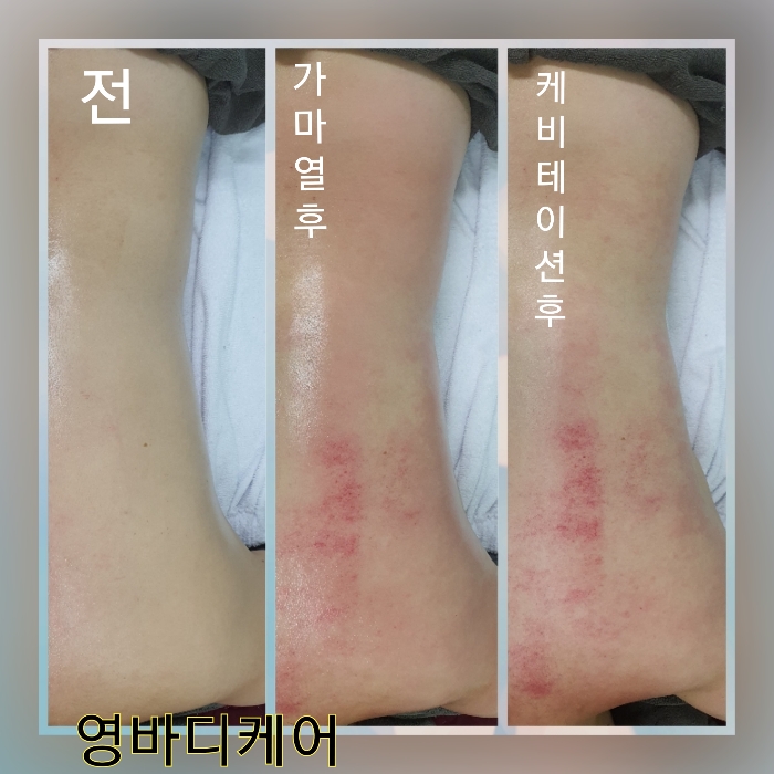 영바디케어