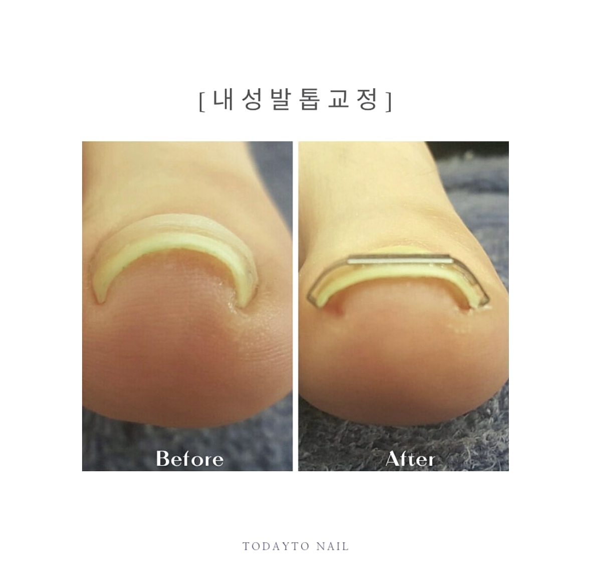 오늘도네일