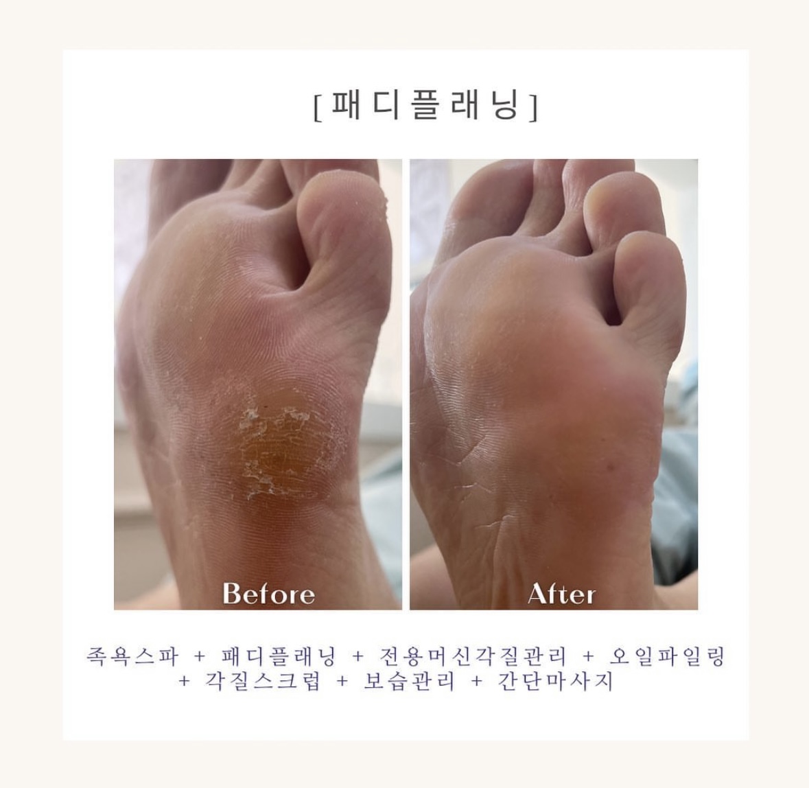 오늘도네일
