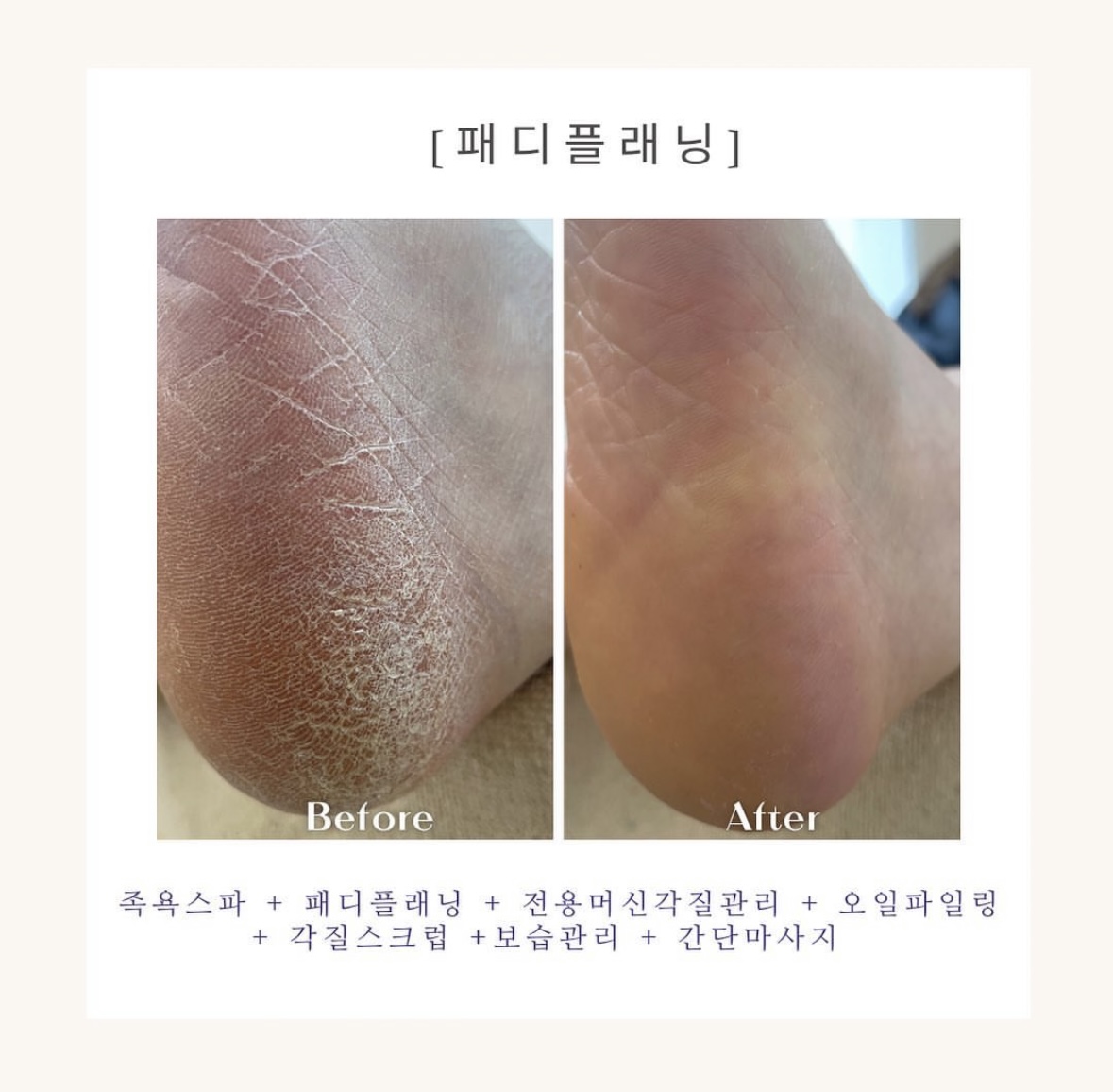 오늘도네일