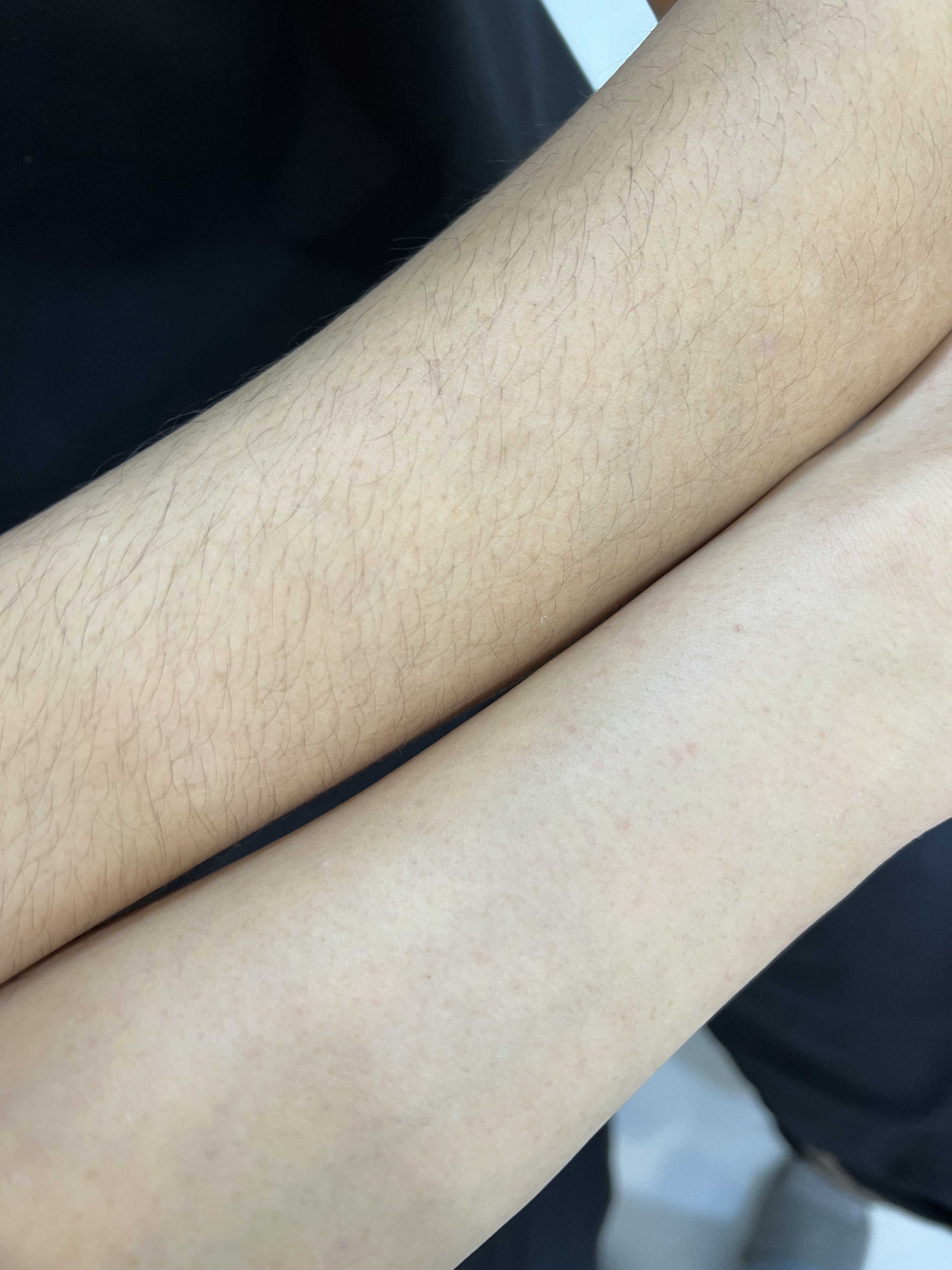 어베인 대표 이미지