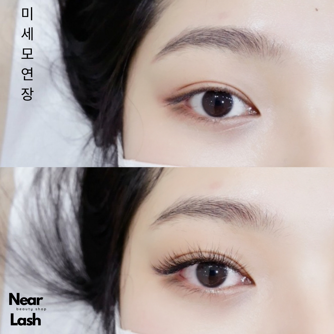 니어래쉬 내외동점