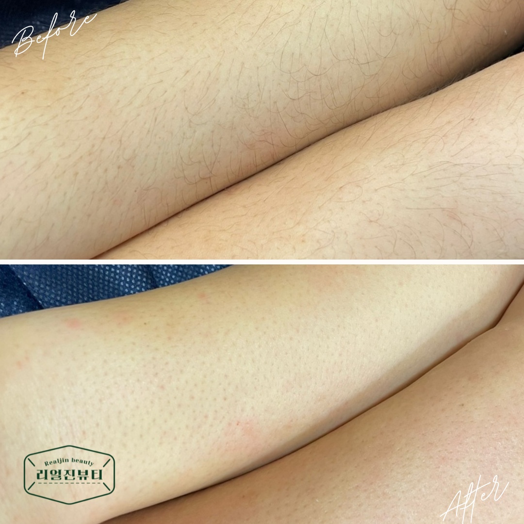 리얼진뷰티 대표 이미지