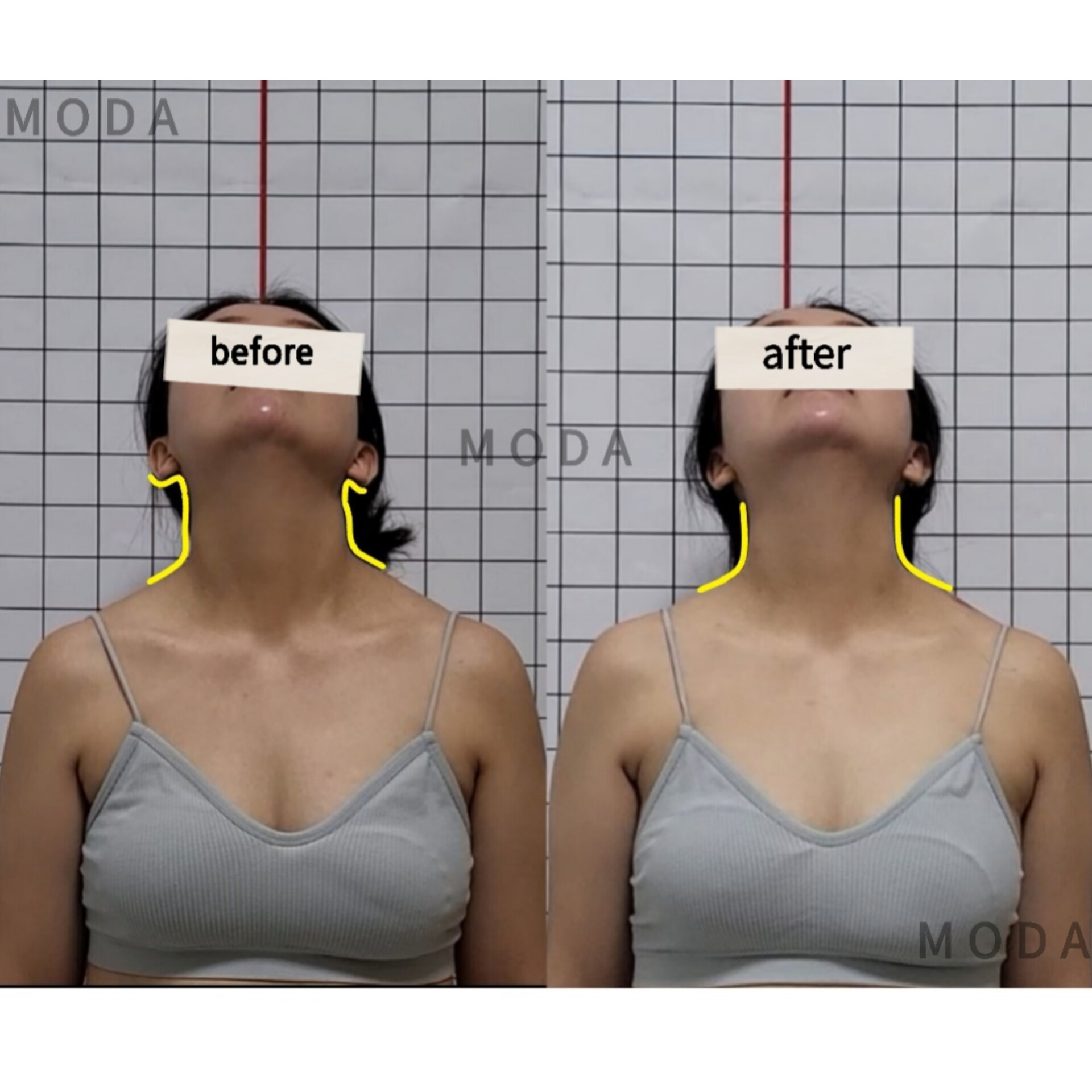 몸에게묻다 바른자세교정센터 대표 이미지