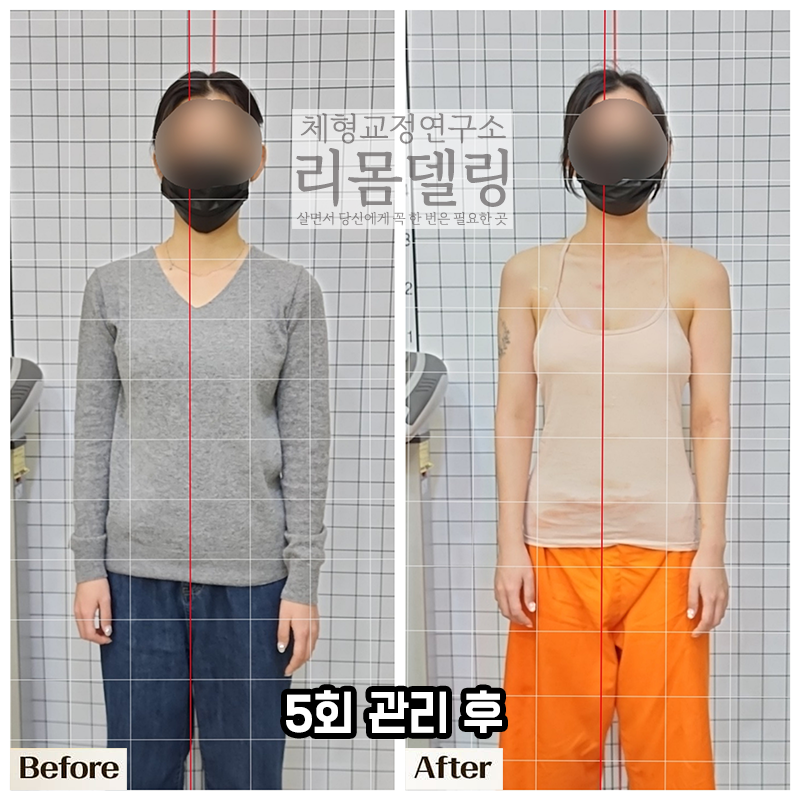 리몸델링체형교정 대표 이미지