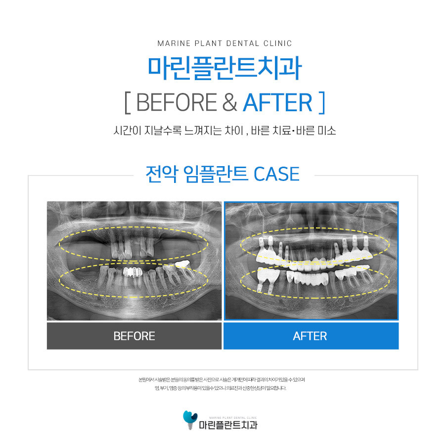 마린플란트치과의원 대표 이미지
