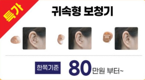 보청기매니져