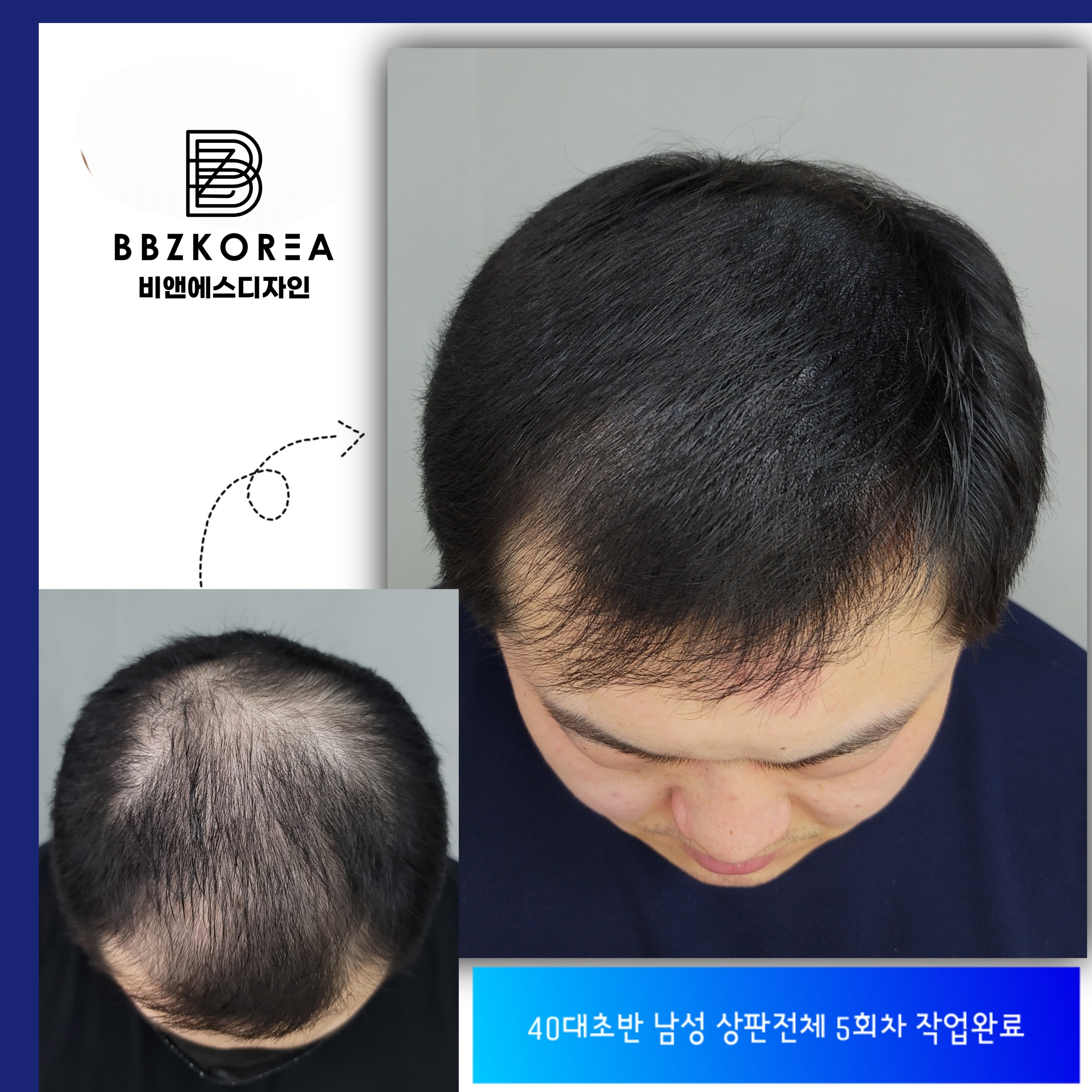 비앤에스디자인