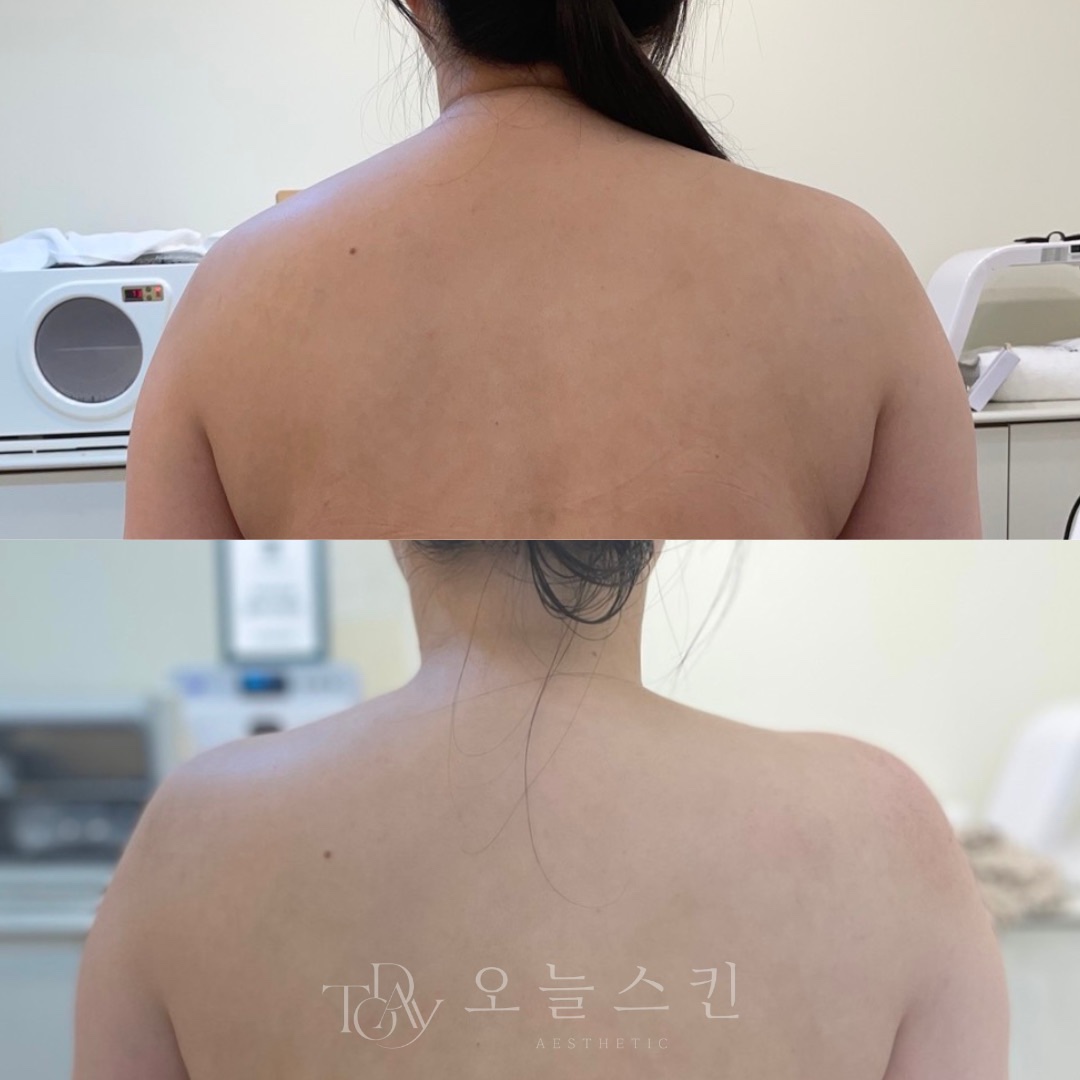 오늘스킨 대표 이미지