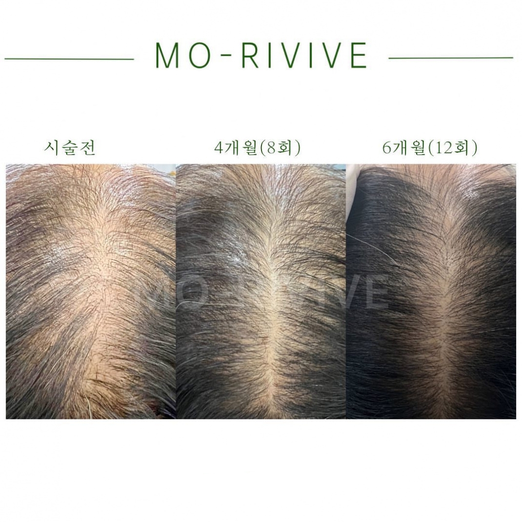 모리바이브 두피탈모케어 홍대점 대표 이미지