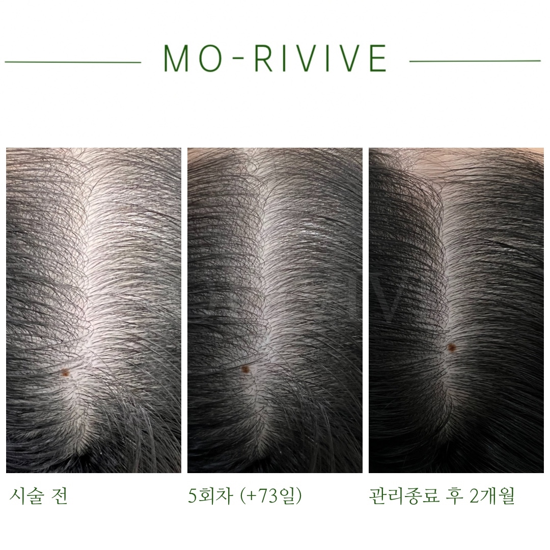 모리바이브 대표 이미지