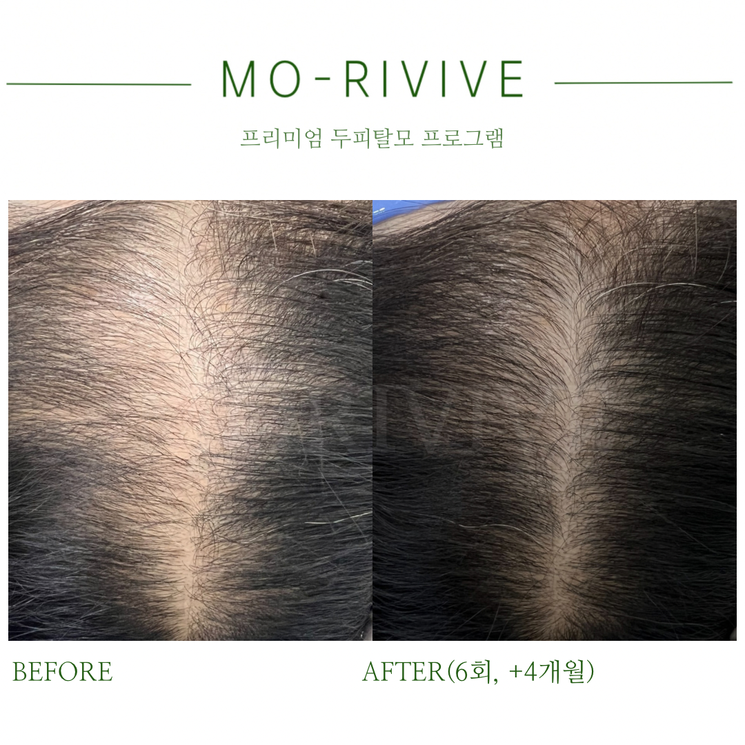 모리바이브 대표 이미지